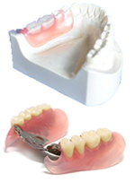 片側処理義歯 画像